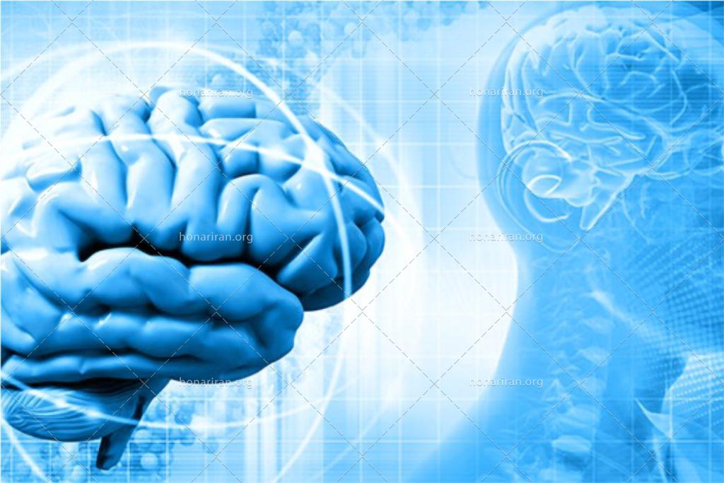 عکس با کیفیت مغز انسان در کنار عکس سی تی اسکن