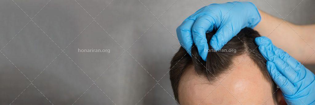 عکس با کیفیت پزشک در حال ماساژ مو