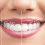 دیوارکوب زیبایی لبخند